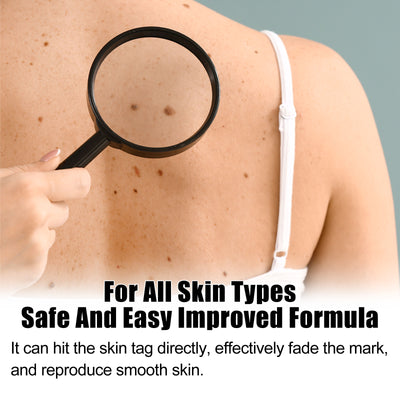 Skin Mole Care Suit Body Cleaning