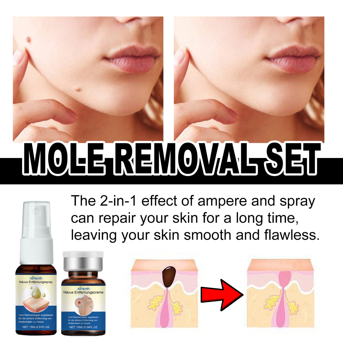 Skin Mole Care Suit Body Cleaning